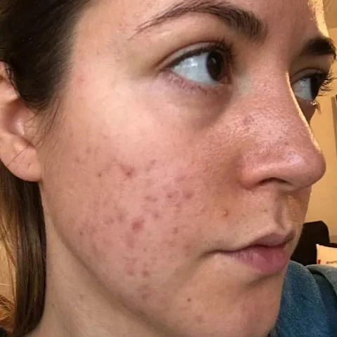 Antes - María José